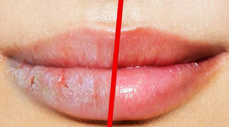 12 TIPS PARA CURAR LABIOS SECOS